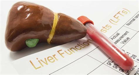 liver blood tests good but abdomen enlarged and hard|pictures of enlarged liver.